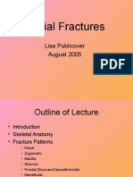 Facial Fractures