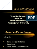 Basal Cell Carcinoma