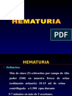 Hematuria