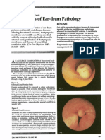 A Mini-Atlas of Ear-Drum Pathology PDF