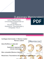 Lesiones Meniscales