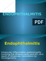 Endophthalmitis FKG