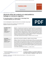 Afectacion Difusa Del Cerebelo en Edad Pediatrica