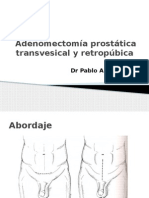 Instrumentacion Prostata