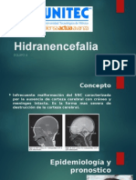 Hidranencefalia