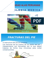 Fracturas de Pie