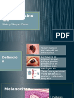 MELANOCARCINOMA