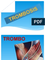 TROMBOSIS