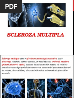 Scleroza Multipla