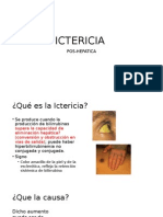 ICTERICIA POSHEPATICA.pptx