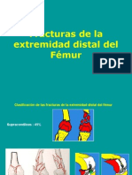 02 - Fractura Del Extremo Distal Del Femur