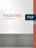 TUGAS EKG