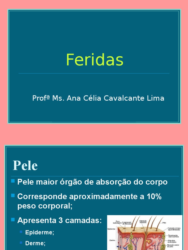 Guia Completo sobre Feridas e Tratamento | PDF | Necrose | Pele