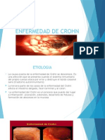 Enfermedad de Crohn