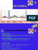 EKG Normal DR - Sibli