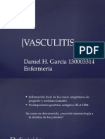 Vasculitis