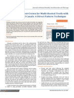 Multi-Piece Post-Crown For Multi-Rooted Teeth With Non-Parallel Canals