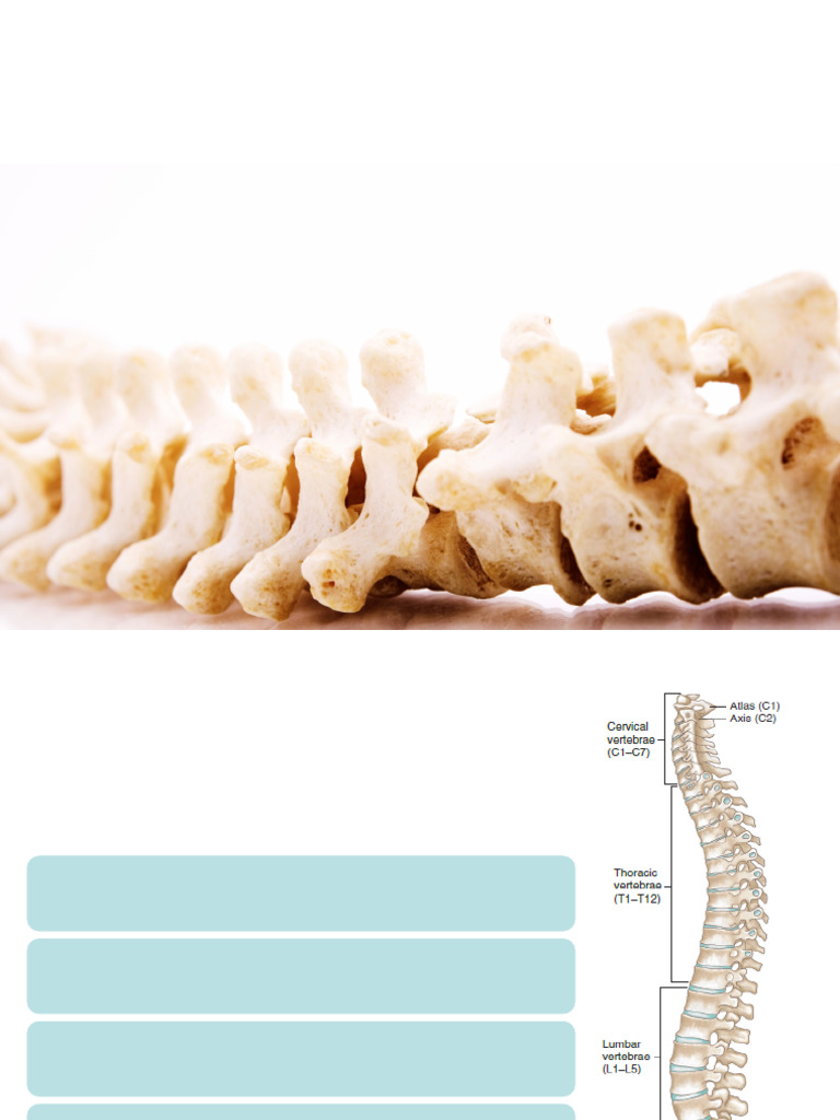 Quels sont les traumatisés du rachis