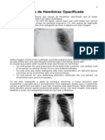 Radiologia Apostila - Pneumotórax -Estudo do coraçao - Causas de Hemitórax Opacificado