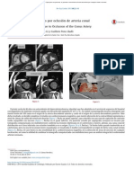 Sindrome Coronario Agudo PDF