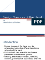 Benign Tumours of The Hand