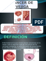 CA Vejiga: Diagnóstico y Tratamientos