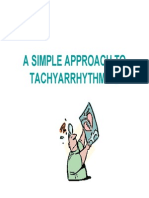 Tachyarrhythmia Package