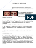 Disputa Marca De Mordedura En La Evidencia