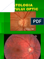 5 Patologia Nervului Optic