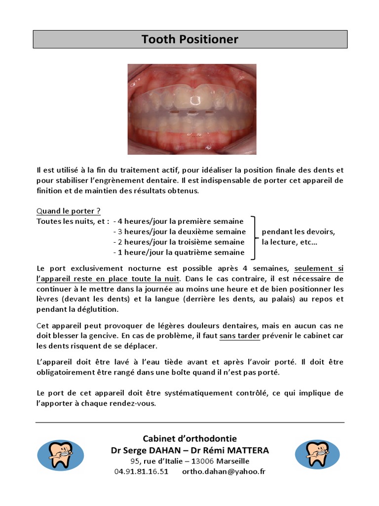 Tooth Positioner | PDF