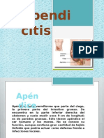 Apendicitis