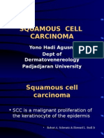 Squamous Cell Carcinoma