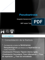 Pseudoartrosis