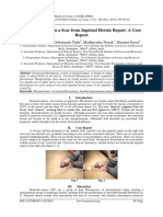 Desmoid Tumor in A Scar From Inguinal Hernia Repair: A Case Report