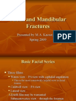 Facial and Mandibular Fractures