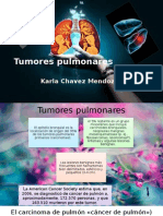 Tumores Pulmonares