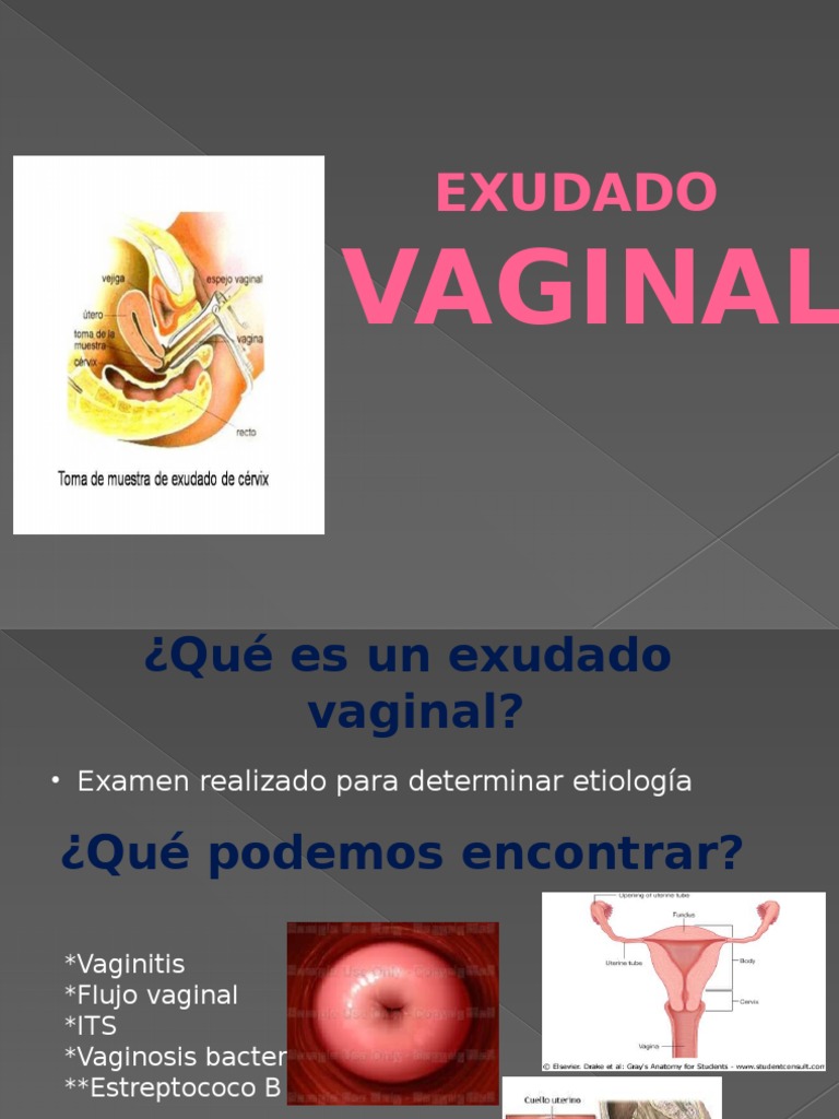 Expo Exu Da Do Vaginal Estreptococo
