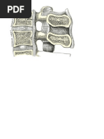 Treatment of Degenerative Disc Disease