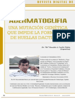 Adermatoglifia - Una Mutación Genética Que Impide La Formación de Huellas Dactilares
