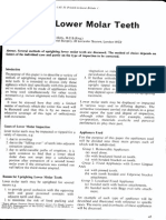 Uprighting Molar Lower Teeth