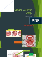 Cancer de Cavidad Oral