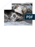 01 Skull of Homo Erectus Throws Story of Human Evolution Into Disarray