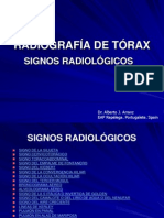 Radiografia de Torax Signos Radiologicos