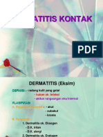 Dermatitis Kontak