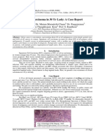 Clitoral Carcinoma in 30 Yr Lady: A Case Report