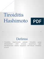 Tiroiditis Hashimoto