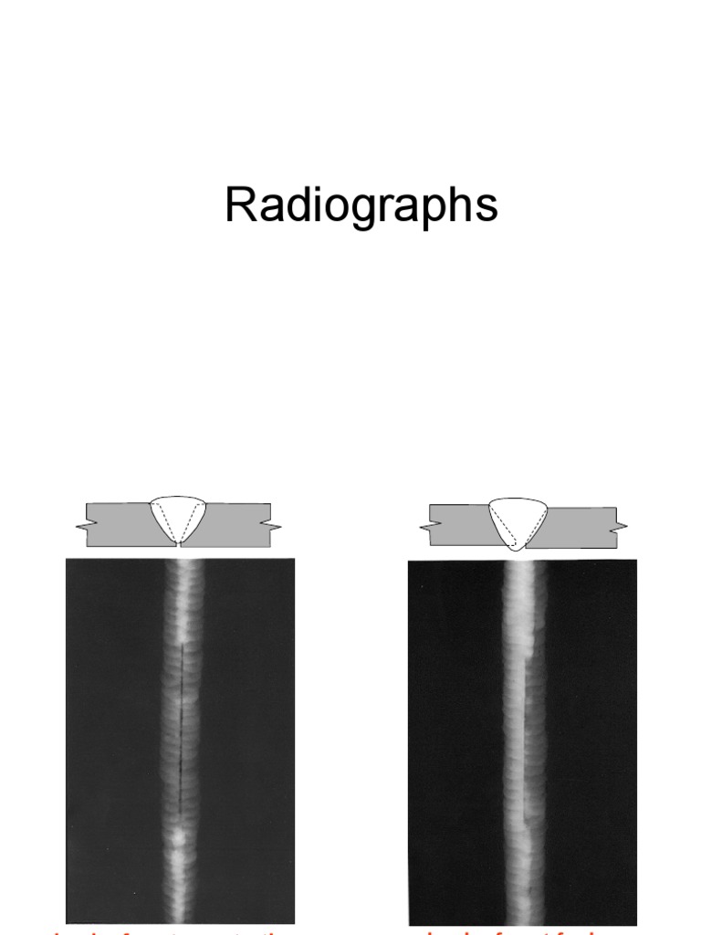 Radiographic Interpretation Graphs Guideline | PDF | Art