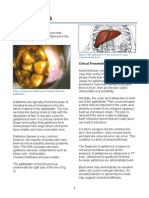 Cholelithiasis: Information For Patients