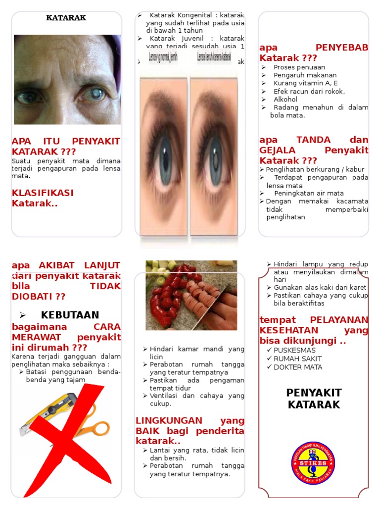 Leaflet Katarak