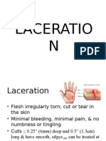 Aeron Lamsen (Laceration)